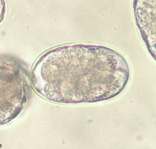 Ancylostoma