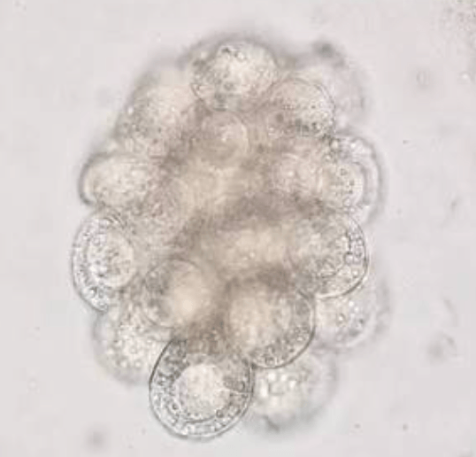 Dipylidium