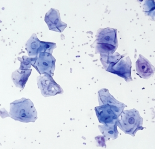 Estro