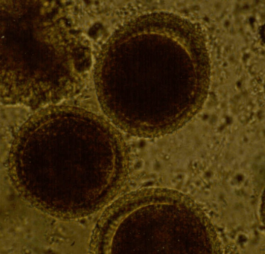 Toxocara